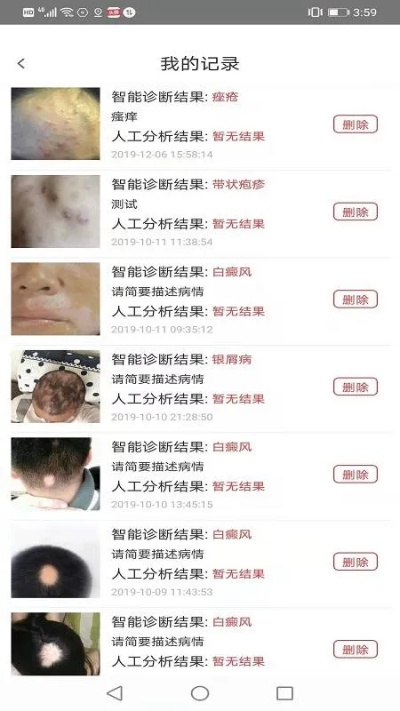 皮肤专家软件对比分析，深度解析皮肤 专家官方下载及成都激活码 剑三与寻找皮肤专家