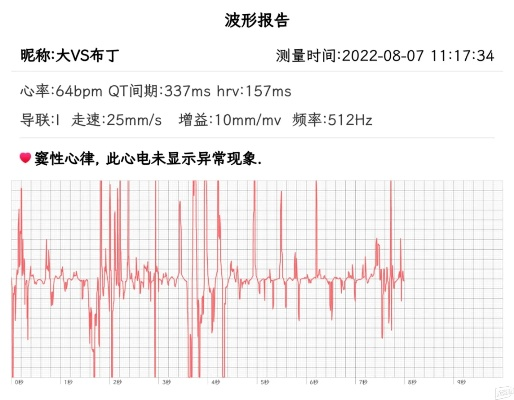 发动机心电图官方下载或天龙礼包激活码,科学化方案实施探讨 创新版_v10.475